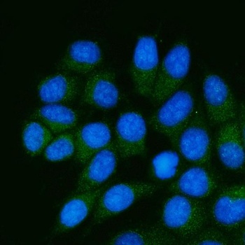 TSTA3/GFUS Antibody