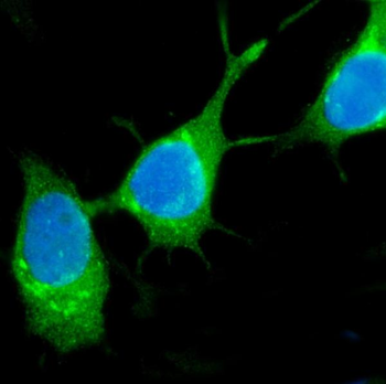 Anti-TFF1 Antibody
