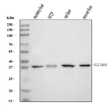 SLC10A1/NTCP1 Antibody
