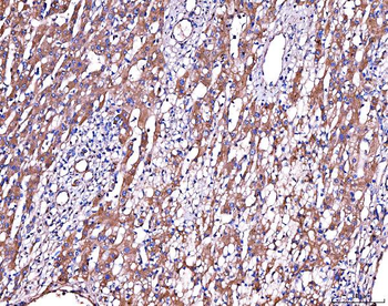 Anti-Alpha 2 Antiplasmin/SERPINF2 Antibody