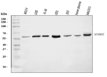 S6K1/RPS6KB1 Antibody