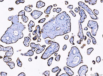 Anti-LNPEP Antibody