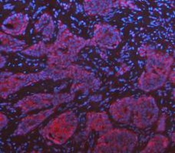 Anti-KRT7 Antibody