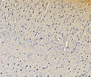 Anti-Histidine decarboxylase/HDC Antibody