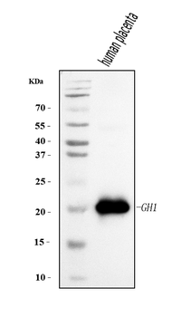Anti-Growth Hormone/GH1 Antibody