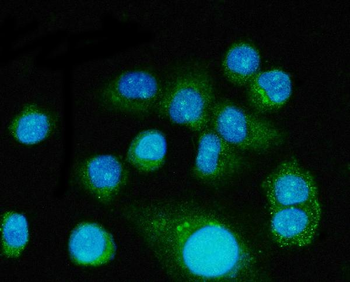Anti-FGF2 Antibody