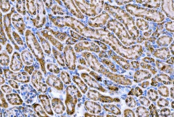 Anti-CPT1A Antibody