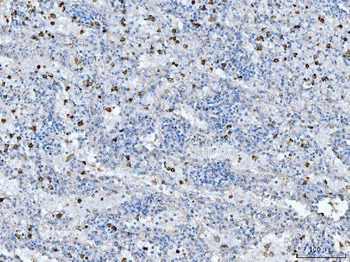 Anti-CD14 Antibody