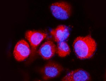 Anti-ATP6V1A Antibody