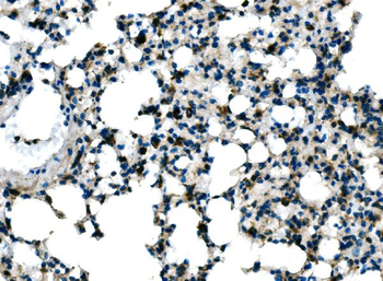 Anti-Tlr8 Antibody