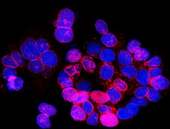 Anti-SUN2 Antibody