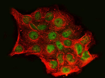 Anti-SnoN/SNO/SKIL Antibody