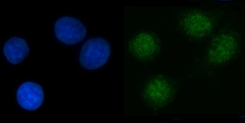 Anti-NPL4/NPLOC4 Antibody