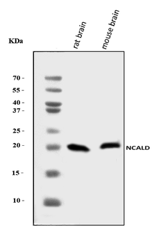 Anti-NCALD Antibody