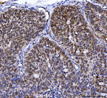 Anti-MLH1 Antibody