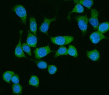 Anti-ME1 Antibody