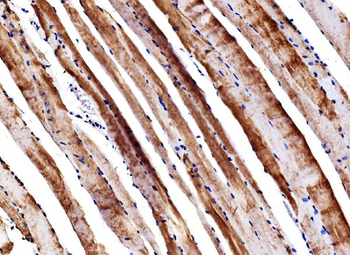 Anti-ENO3 Antibody