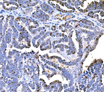 Anti-DPY19L1 Antibody