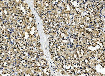 Anti-CSNK2B Antibody