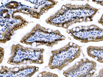 Anti-CSNK2A2 Antibody