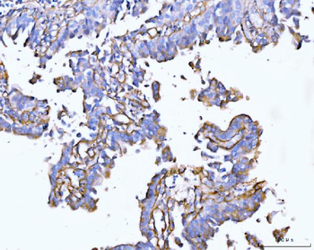 Anti-Collagen VI/COL6A2 Antibody