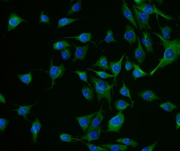Anti-Chromogranin A/Chga Antibody