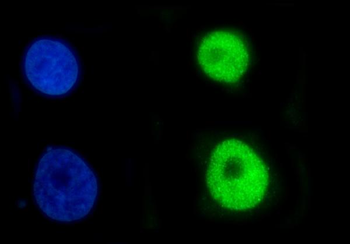 Anti-CBX2 Antibody