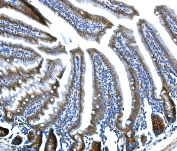 Anti-Btc Antibody