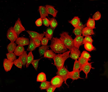 Anti-ADAR1/ADAR Antibody