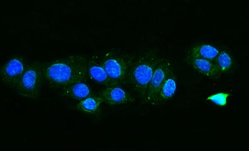 Anti-TTC11/FIS1 Antibody