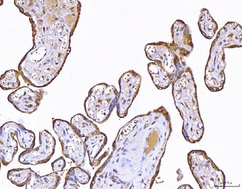 Anti-PP11/ENDOU Antibody