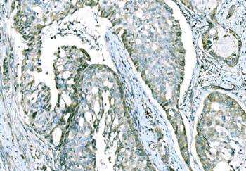 Anti-CD101 Antibody