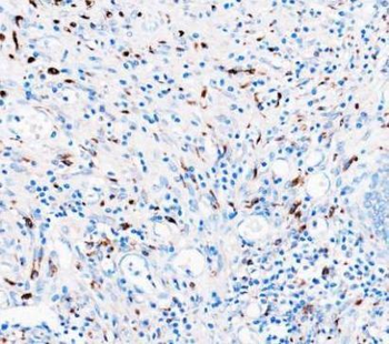 Anti-CD68 Antibody