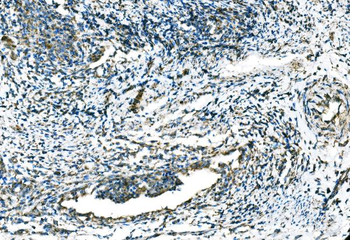 Anti-CCR2 Antibody