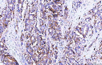 Anti-Poliovirus Receptor/PVR Antibody (monoclonal, 9B9F1)