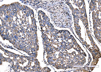 Anti-SOD2 Antibody (monoclonal, 2B12B1)