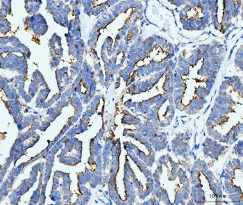 ICAM1 Antibody (monoclonal, 6F2C3)