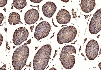 Anti-NAK/TBK1 Antibody