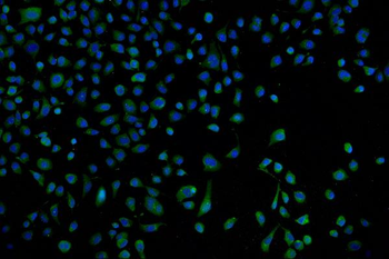 Anti-Proteasome 20S beta 7/PSMB7 Antibody