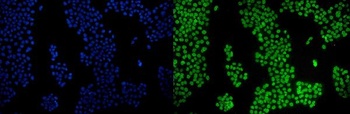 PPAR gamma/PPARG Antibody