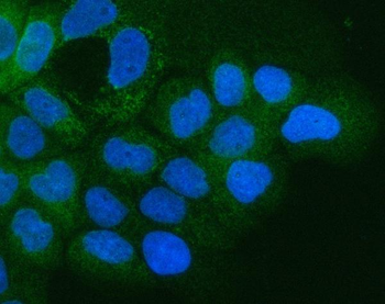Anti-Integrin alpha 3/ITGA3 Antibody
