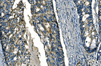 Anti-FGF4 Antibody
