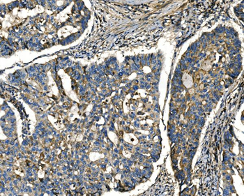 Anti-Apelin/APLN Antibody