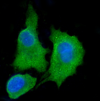 Anti-ALDH3A1 Antibody