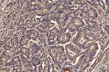 Anti-PDIA6 Antibody (monoclonal, 3H5E7)