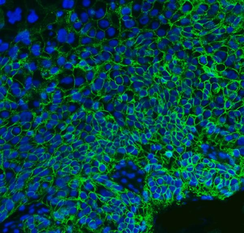 Anti-CD147/Emmprin Antibody (monoclonal, 6H2B2)