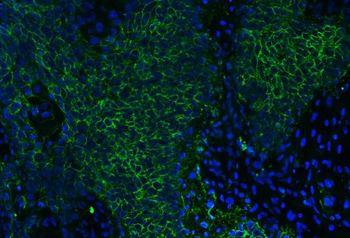 Anti-CD147/Emmprin Antibody (monoclonal, 3B13G7)