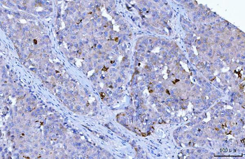 Anti-HGS Antibody (monoclonal, 6C2E1)