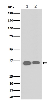 Anti-ELOVL5 Rabbit Monoclonal Antibody
