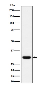 Anti-Adiponectin Rabbit Monoclonal Antibody